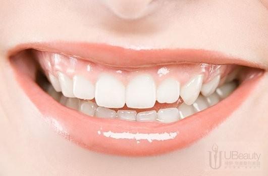 口腔结石怎么来的 13-360078-QQ%BD%D8%CD%BC20140110143710.jpg