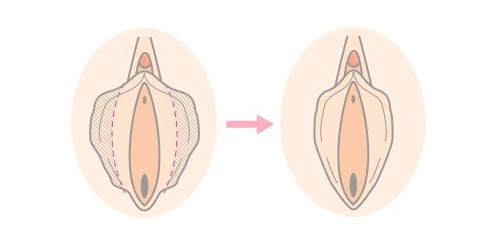 其他隐私整形_其他隐私整形专家_其他隐私整