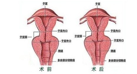 2019年缩阴产品排行榜_缩阴产品效果排行榜,2019新排名