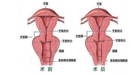 2019年缩阴 排行榜_缩阴产品效果排行榜,2019新排名