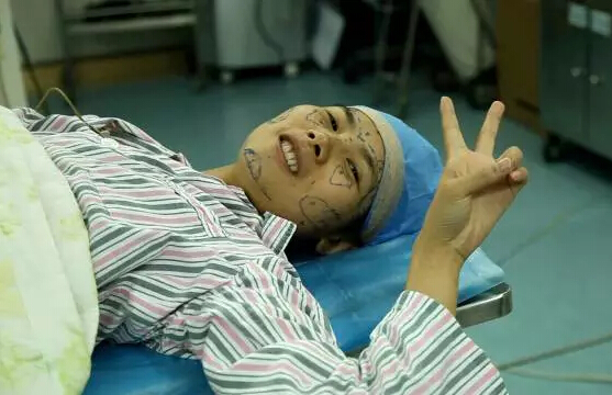 进手术室了,期待蝶变